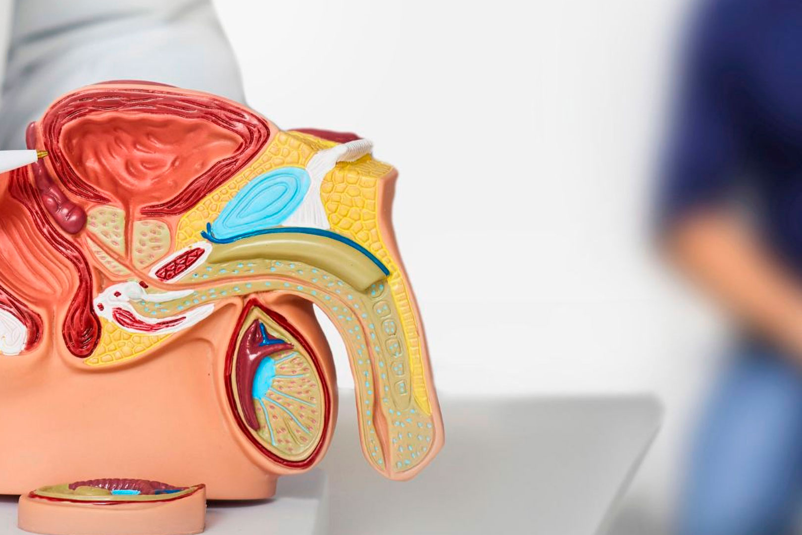 Biopsia de próstata