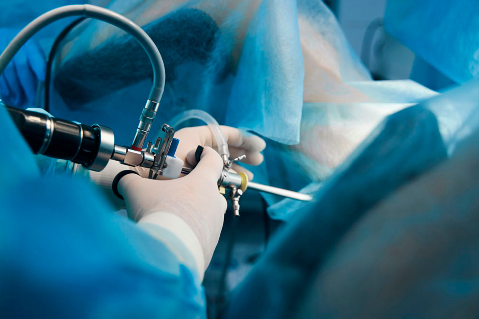 Colocación de catéter doble jota