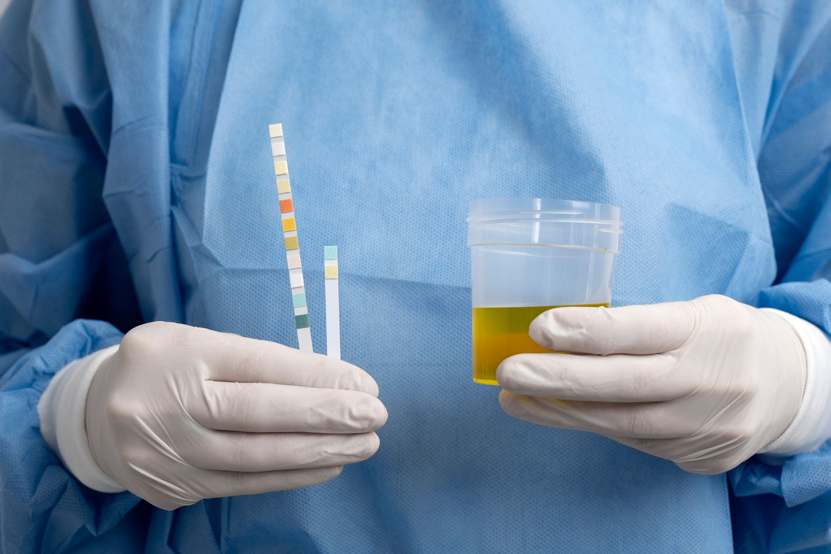 Estudio urodinámico