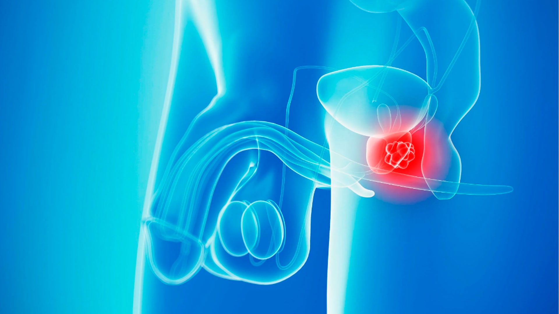 Flujometría: estudio del flujo de orina