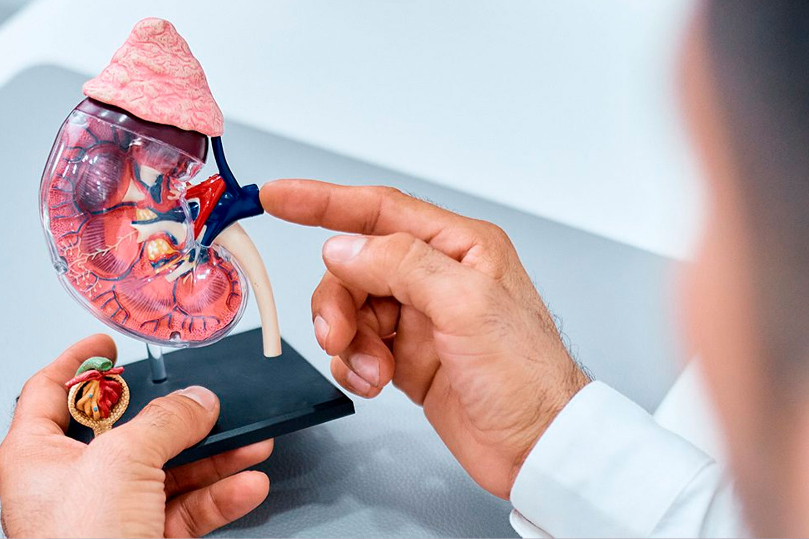 Cambios de nefrostomía